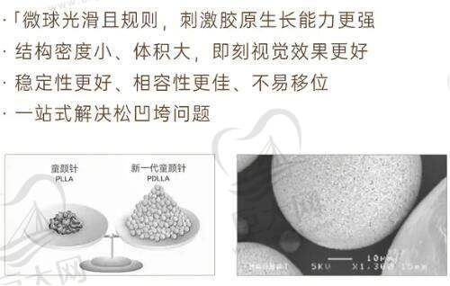 王牌项目介绍