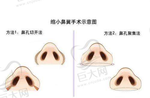 服务管理体系