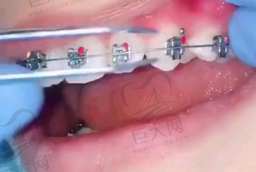 北京诚之康口腔门诊地址及性价比分析