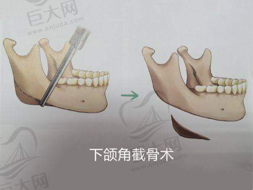 南京京科医院2025年价格表