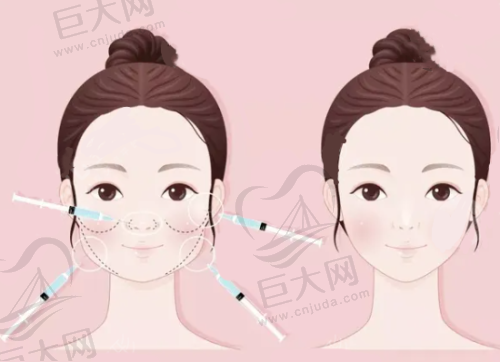 综合考量是否值得去南宁吴刊美丽星医疗美容医院