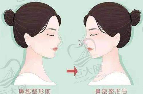 光子嫩肤实例体验