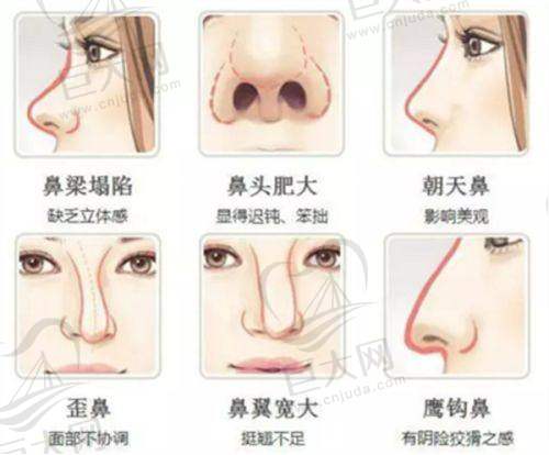 与南宁其他整形医院对比