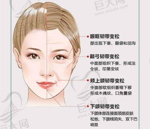 面部提升优势多