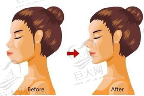 预约挂号便捷