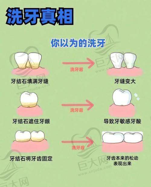 无锡美呀种植专科优惠价格给力