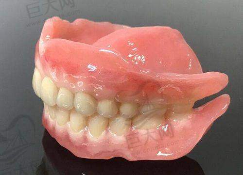 患者实例分享