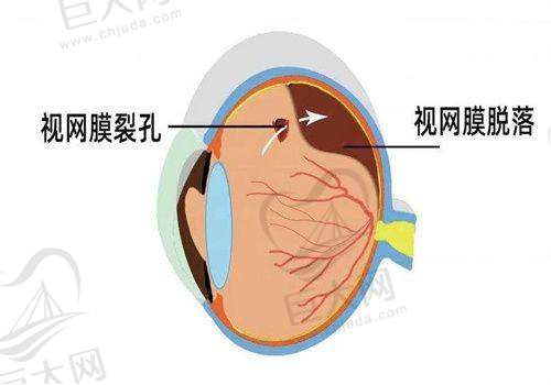 海口国爱眼科优势凸显