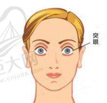 商丘尖峰眼科医院的术前检查