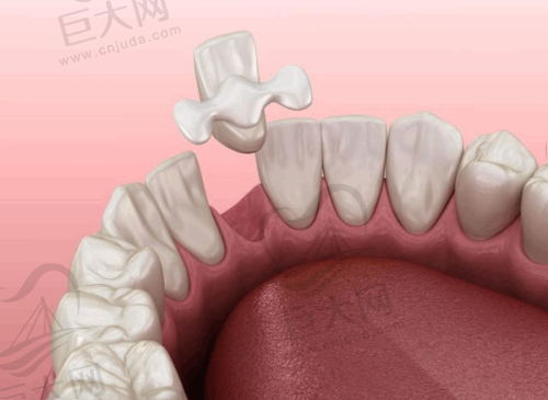 绍兴牙名仕口腔提供多样选择