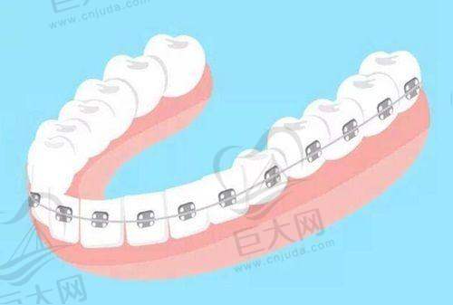 不同医院的正畸价格情况