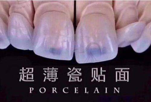 南京牙菅家口腔医院收费合理服务优