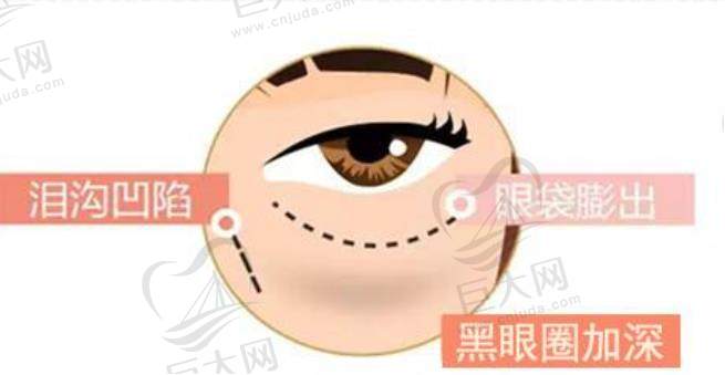 乌鲁木齐祛黑眼圈愁坏了爱美人士？分享新疆青松星范门诊部项目体验及优势 