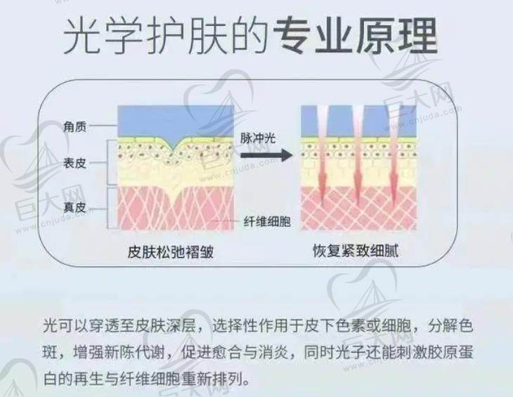 想了解北京京城皮肤医院激光美容项目？资质、医生、技术、价格优势全揭秘！ 