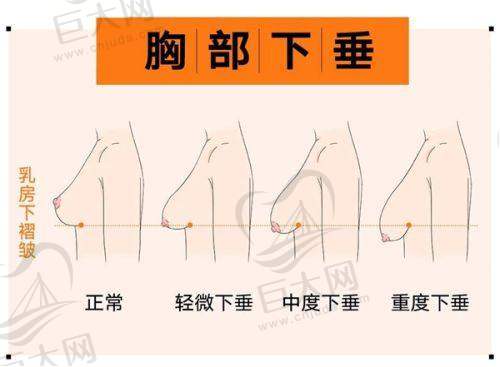 热玛吉项目详情