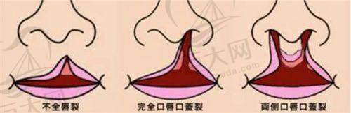 哈尔滨市第一医院皮肤科技术力量雄厚