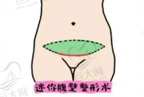 合肥华美整形医院的医生实力