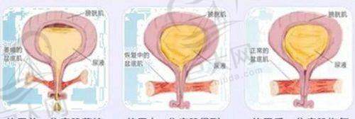 亲测深圳婳美皮肤激光项目！祛斑去皱效果惊人，专业服务让我放心变美 