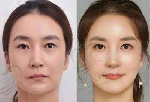 衡阳美莱医疗美容医院的价格情况