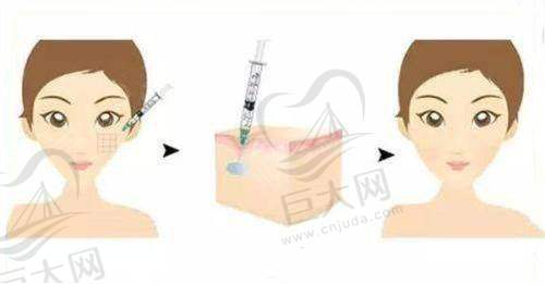 想了解武汉同济医院皮肤激光项目？热玛吉、点阵激光等效果、价格及案例全揭秘！ 