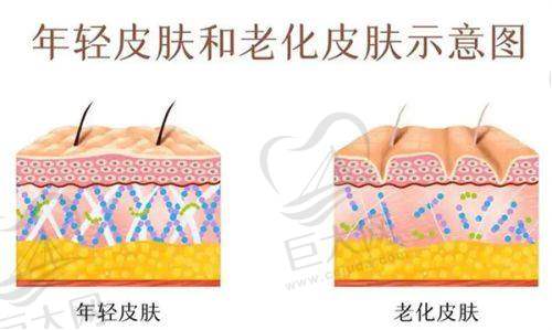 选择玻尿酸医生要注意什么？