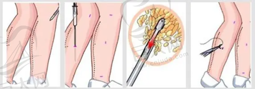 特色项目价格合理