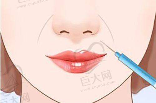 医生团队特别专精
