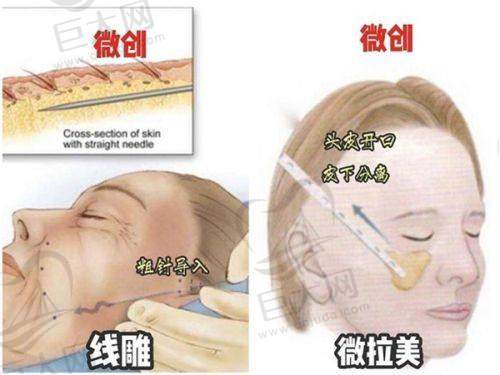 特色项目丰富多样