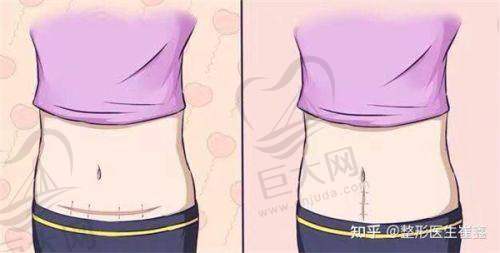 福州市皮肤病防治院专科优势明显