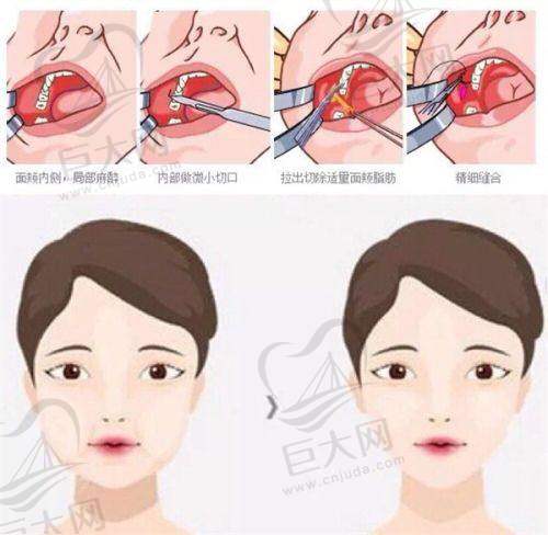 哈尔滨皮肤科医生值得信赖