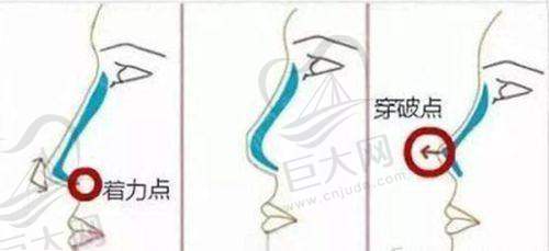 医生团队实力雄厚