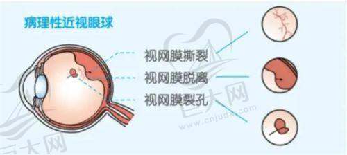 服务质量与患者评价良好
