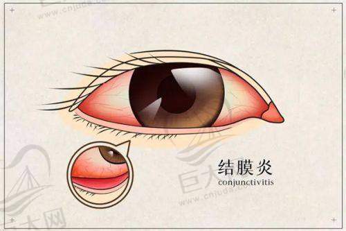 手术保护有力