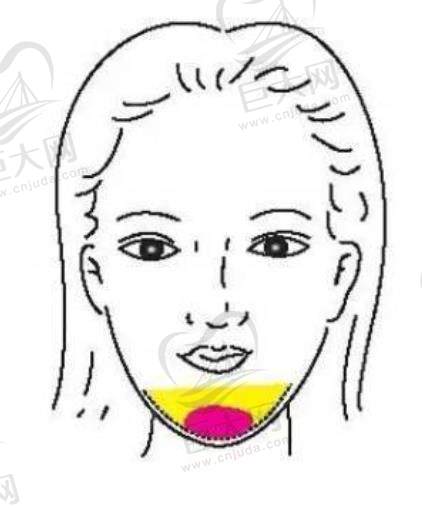 石家庄创美医疗美容：国产威宁硅胶下巴9800元起，多项目变美，预约开启精致之旅 