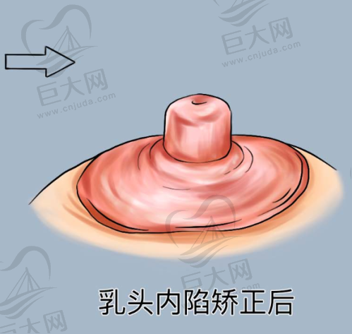 专精的注射玻尿酸医生团队