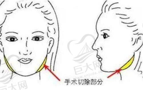 不同城市润致水光收费情况