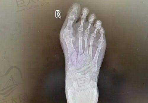 价格参考明晰