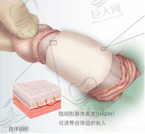 口碑良好，患者认可