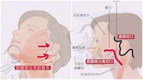 年底福利!长沙雨花脸博士医美门诊部轮廓塑形 15800 元起,199 款项目 1 元开抢!