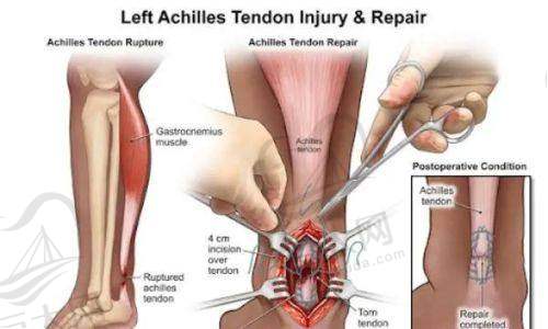 门诊部注射玻尿酸优势明显