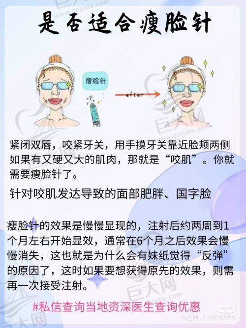 脂肪填充技术精良，成效显著