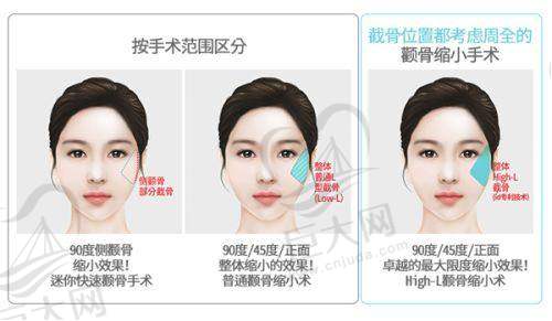 瑞蓝 - 定彩价格有其合理性