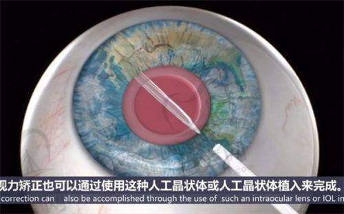 其他眼科项目价格