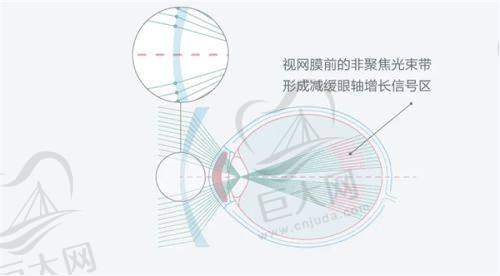 不同手术方式价格多样