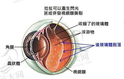 多地飞秒手术价格：各有特色显优势
