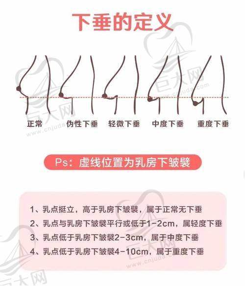 专精医生建议