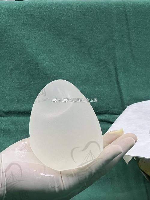 影响变软速度的五大因素