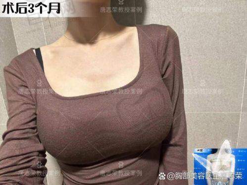 傲诺拉假体真的会被捏爆吗？