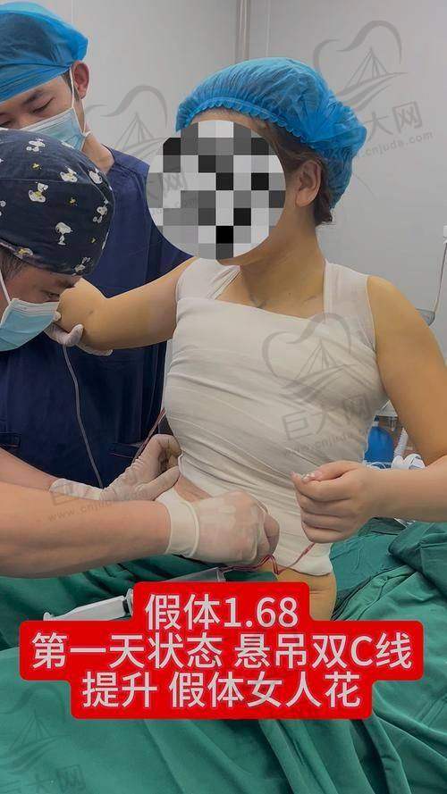 真实实例分享
