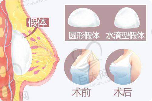 医院和医生推荐